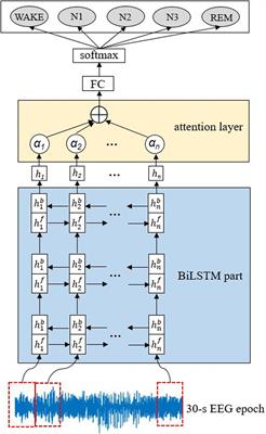 Deep Learning in Automatic Sleep Staging With a Single Channel Electroencephalography